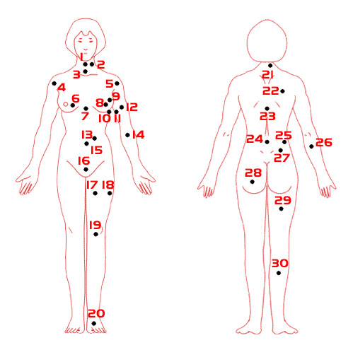 女人身体墨痣图解